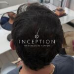 Camuflaje Capilar Inception (Tricopigmentación capilar) - Imagen 5