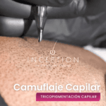 Camuflaje Capilar Inception (Tricopigmentación capilar)